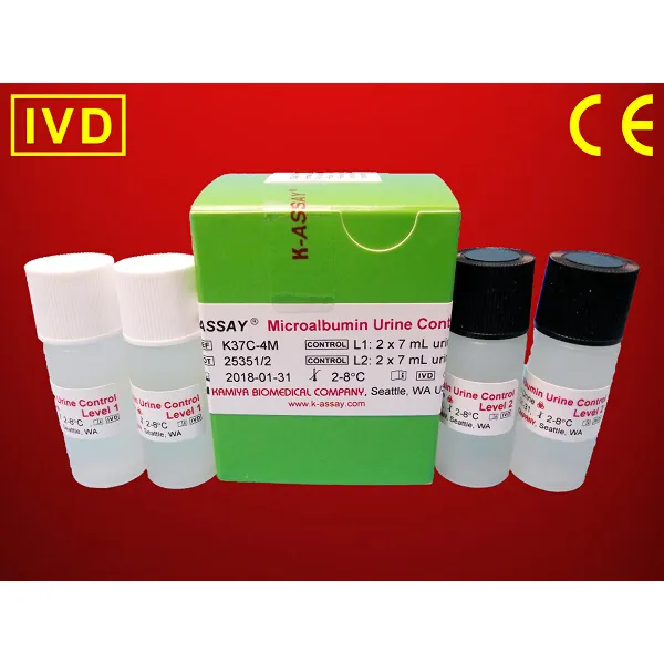 Microalbumin Urine Control